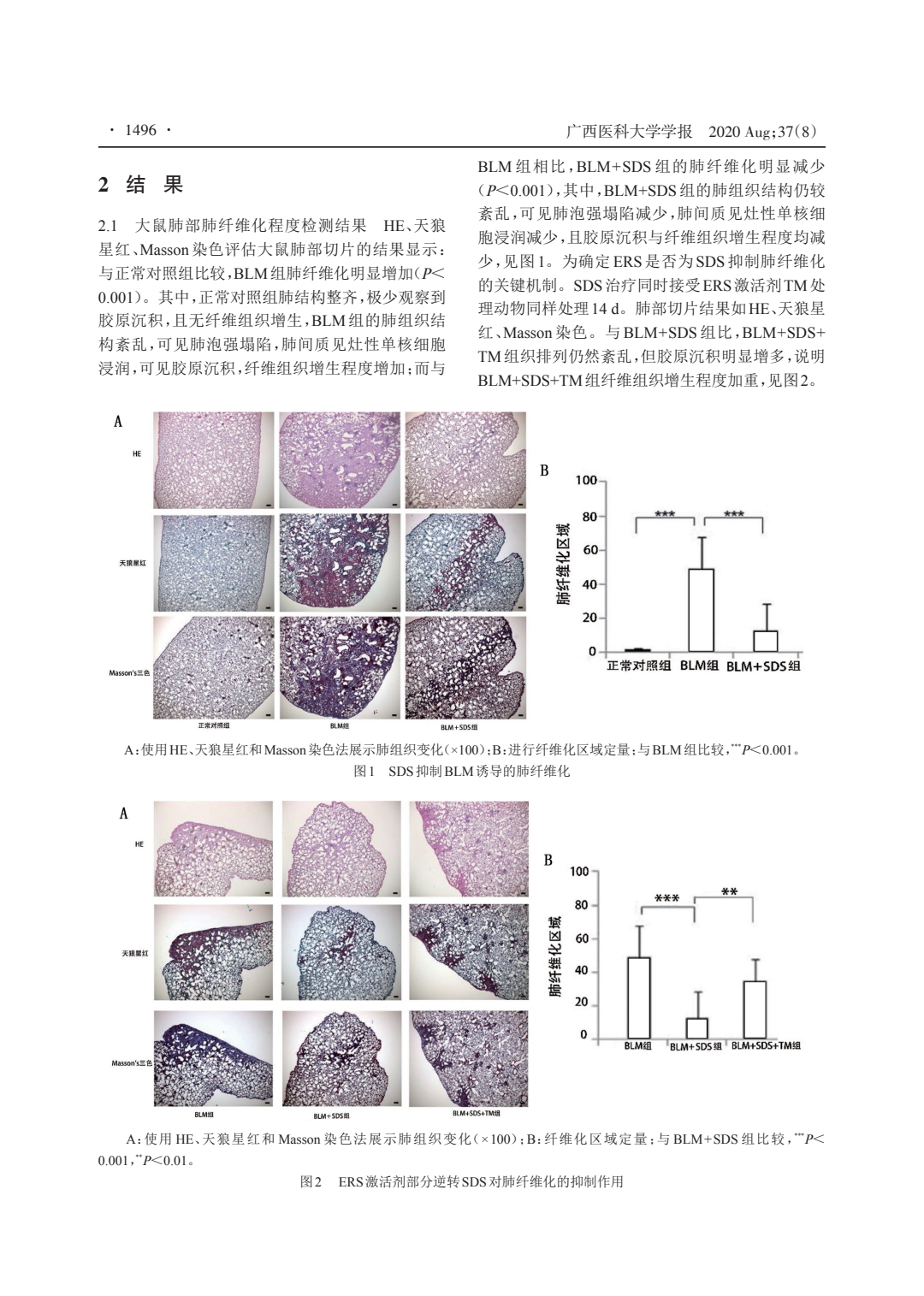 红景天苷对肺纤维化的作用及机制研究_2.jpeg